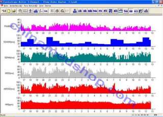 New 3 channel ECG Holter System Recorder+Analyzer  