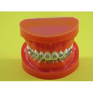  Dental Model Anatomy Typodont Orthodontic Brackets MBT 