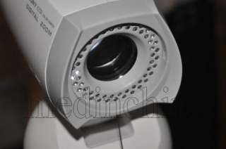   Electronic Colposcope with 830.000 Pixels Sony CCD Camera Gynaecology