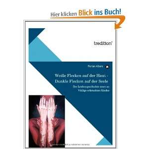   an Vitiligo erkrankten Kindes  Florian Albers Bücher