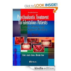 Prosthodontic Treatment for Edentulous Patients Complete Dentures and 